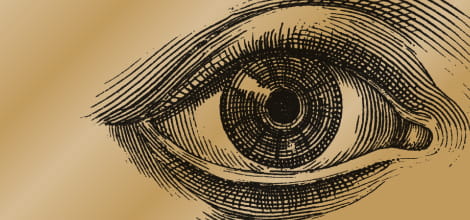 Discolation of cannuala during cataract operation image